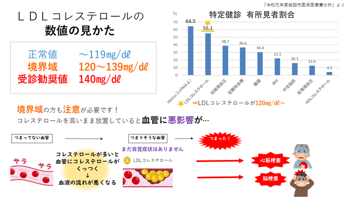 ブルーサークル